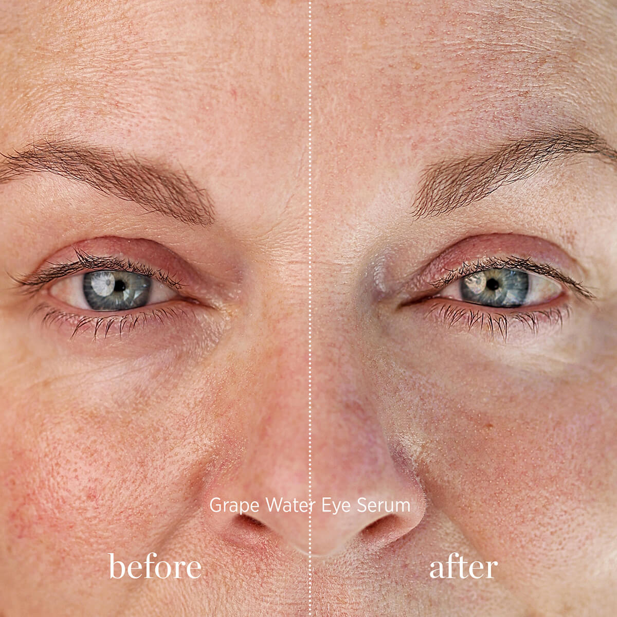 Grape Water Eye Serum - Image 7