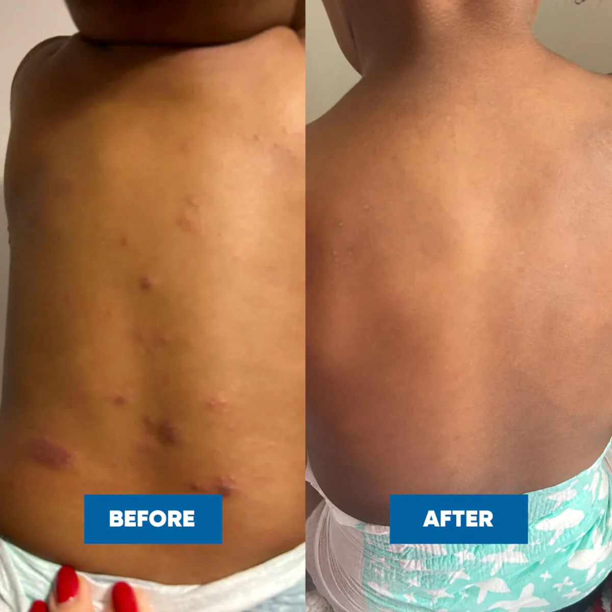 Eczema & Psoriasis Cream - Image 7