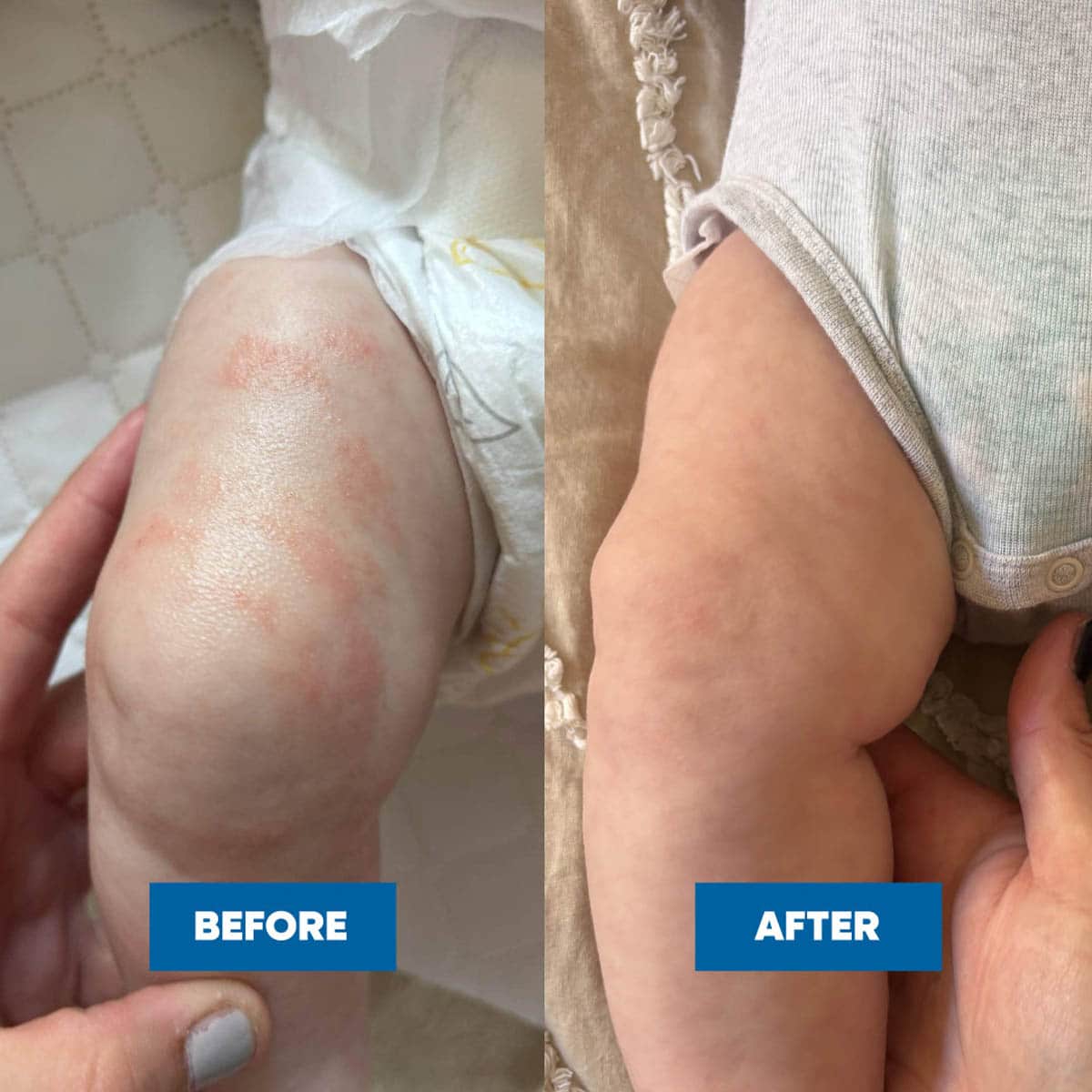 Pink Eczema Cream - Image 5